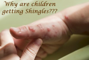 Why are Children Getting Shingles